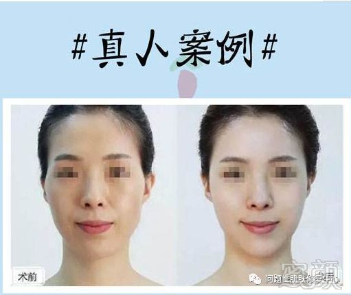 https://img.miyanlife.com/mnt/timg/190904/132ZJ320-11.jpg