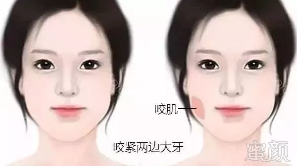 https://img.miyanlife.com/mnt/timg/190904/1330235406-0.jpg