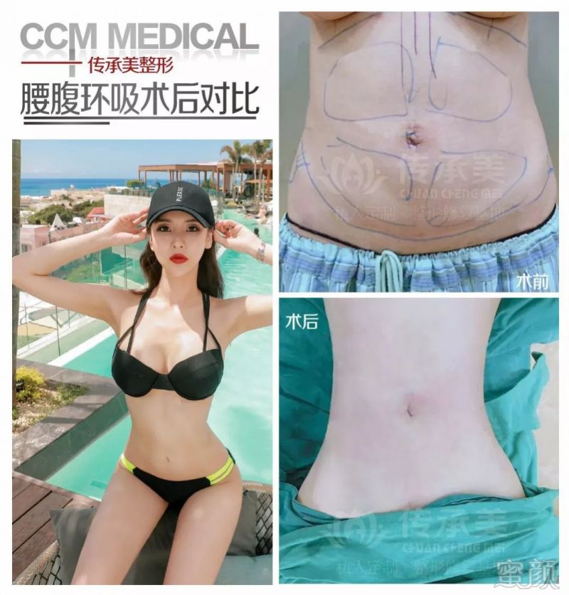 https://img.miyanlife.com/mnt/timg/190904/13332223H-9.jpg