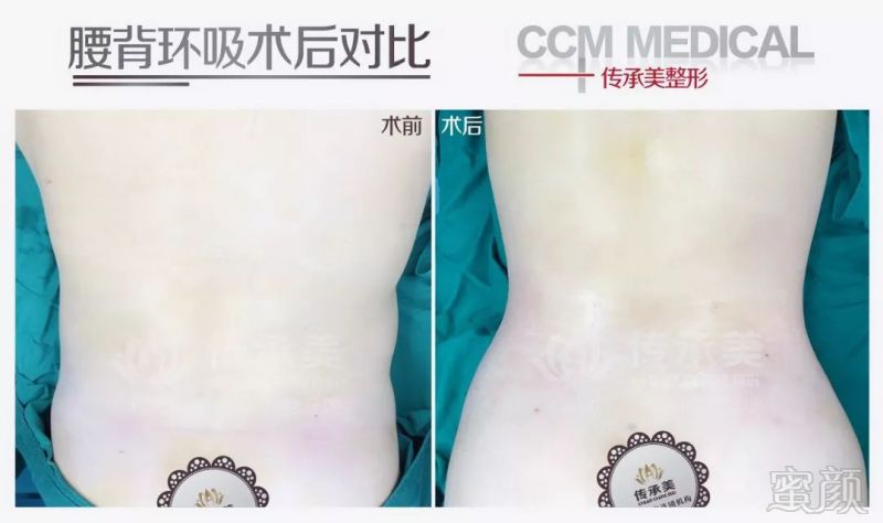 https://img.miyanlife.com/mnt/timg/190904/1333225O5-8.jpg