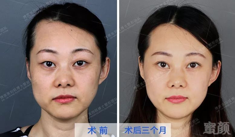 https://img.miyanlife.com/mnt/timg/190905/1F9234V1-2.jpg