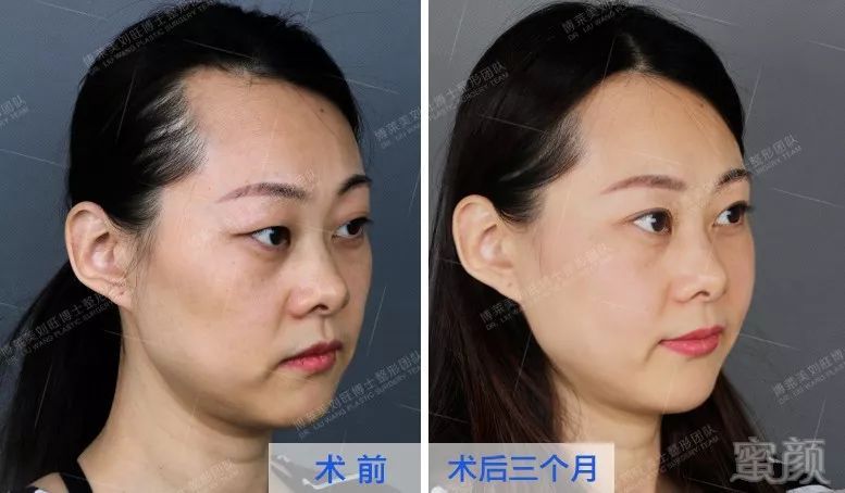 https://img.miyanlife.com/mnt/timg/190905/1F924F50-3.jpg