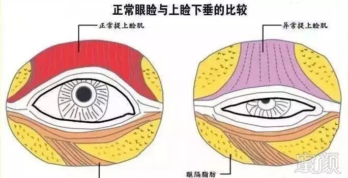 案例图片