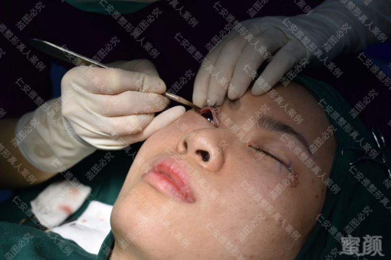 https://img.miyanlife.com/mnt/timg/190905/1G12KK9-8.jpg