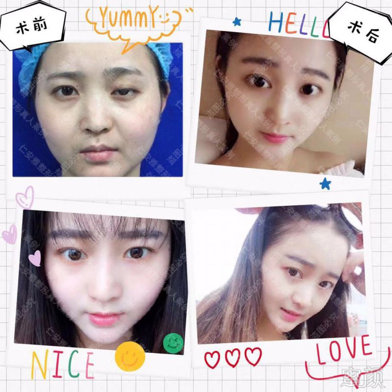 https://img.miyanlife.com/mnt/timg/190905/1G1315223-12.jpg