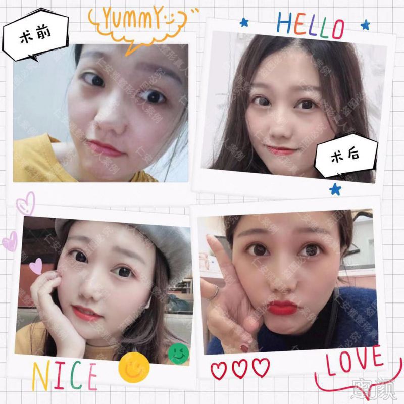 https://img.miyanlife.com/mnt/timg/190905/1G1321H1-13.jpg