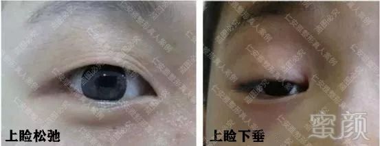 https://img.miyanlife.com/mnt/timg/190905/1G1333249-14.jpg