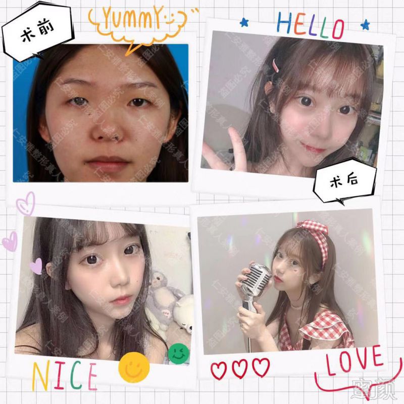 https://img.miyanlife.com/mnt/timg/190905/1G134A60-15.jpg