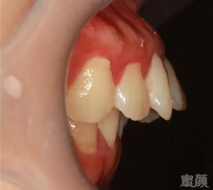 https://img.miyanlife.com/mnt/timg/190905/1I1105196-8.jpg