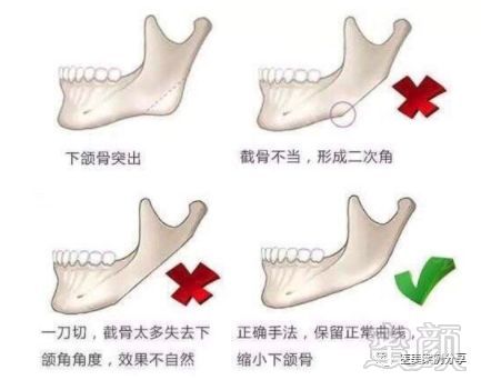 案例图片