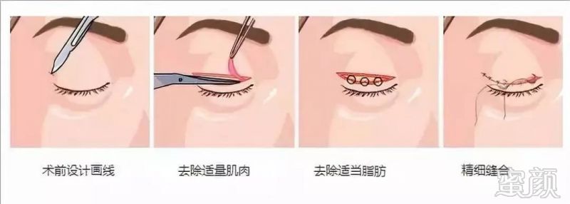 https://img.miyanlife.com/mnt/timg/190906/1911532E2-2.jpg