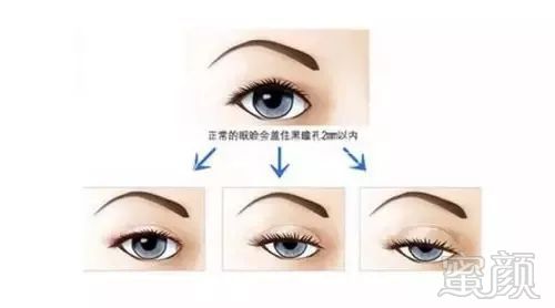 https://img.miyanlife.com/mnt/timg/190906/1911551622-6.jpg