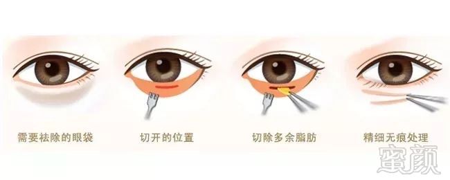 https://img.miyanlife.com/mnt/timg/190906/191155O46-5.jpg
