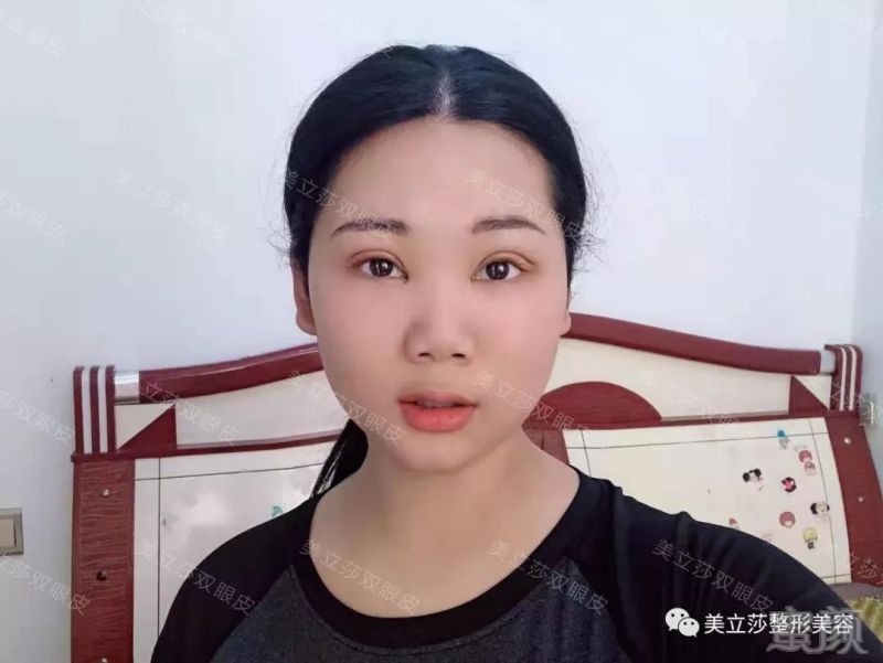 案例图片