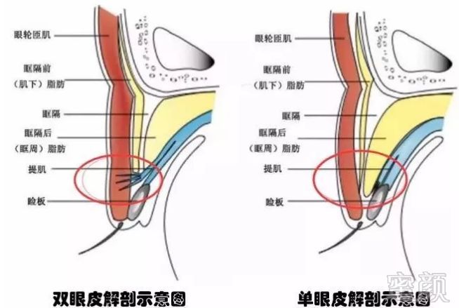 案例图片