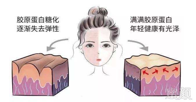 https://img.miyanlife.com/mnt/timg/190907/1159105421-2.jpg