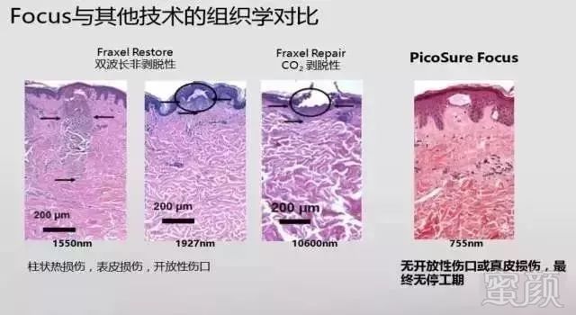 https://img.miyanlife.com/mnt/timg/190907/1239262P7-4.jpg