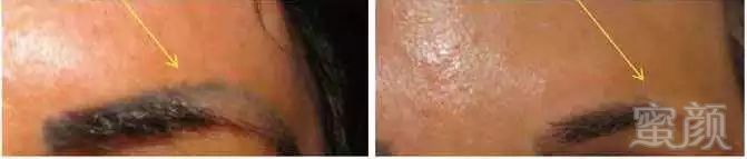 https://img.miyanlife.com/mnt/timg/190907/123G91561-6.jpg