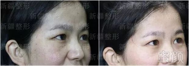 https://img.miyanlife.com/mnt/timg/190907/123H0Bb-8.jpg
