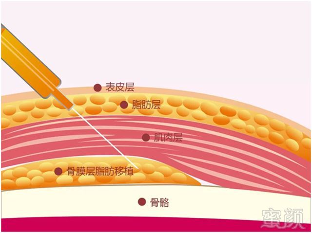 案例图片