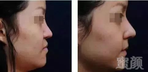 https://img.miyanlife.com/mnt/timg/190908/13050a107-20.jpg