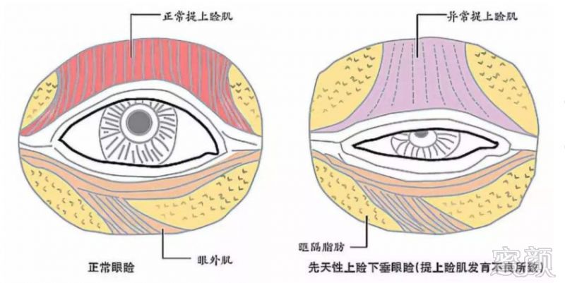 案例图片