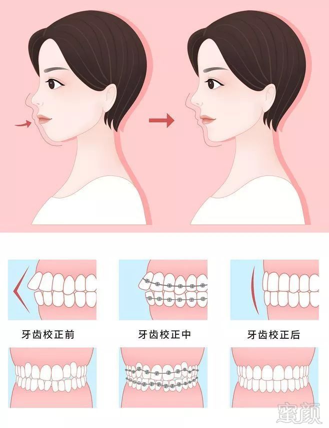 https://img.miyanlife.com/mnt/timg/190908/133102M58-3.jpg