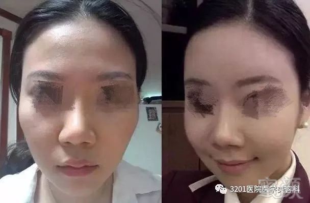 https://img.miyanlife.com/mnt/timg/190908/133QA150-4.jpg