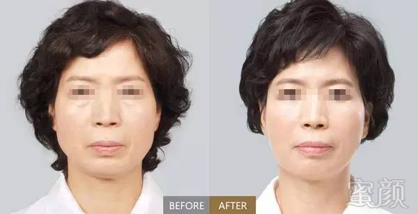 https://img.miyanlife.com/mnt/timg/190908/1352295S5-6.jpg