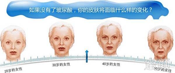 https://img.miyanlife.com/mnt/timg/190908/13522SV8-3.jpg