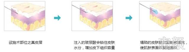 https://img.miyanlife.com/mnt/timg/190908/13522a326-7.jpg