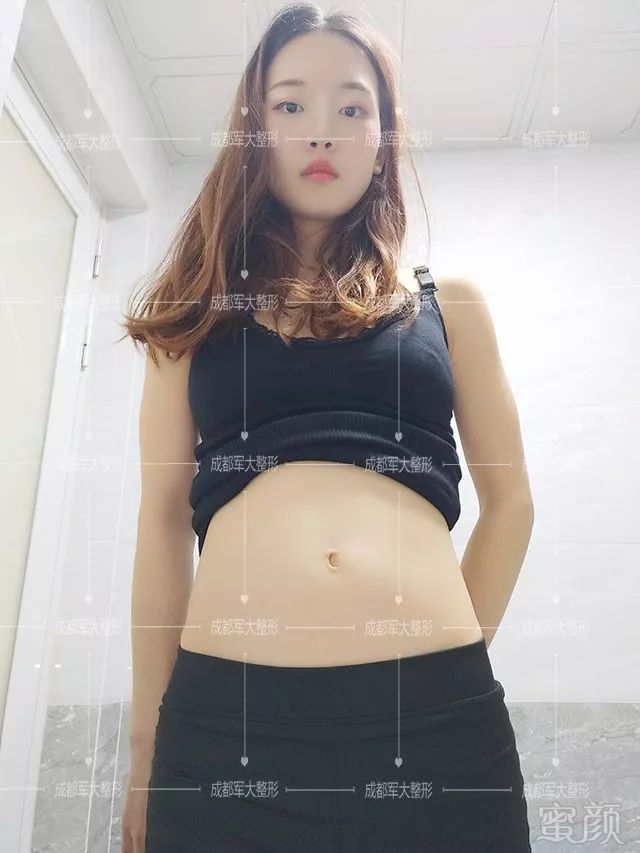 https://img.miyanlife.com/mnt/timg/190909/1F314E46-0.jpg