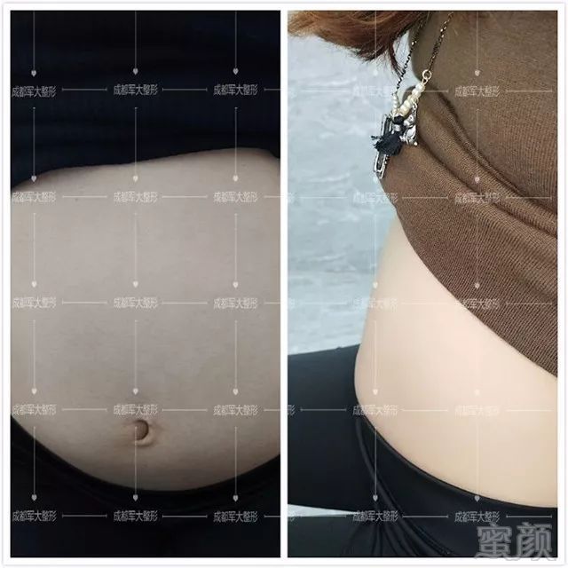 https://img.miyanlife.com/mnt/timg/190909/1F3153243-1.jpg