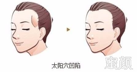 https://img.miyanlife.com/mnt/timg/190909/1F9516022-2.jpg