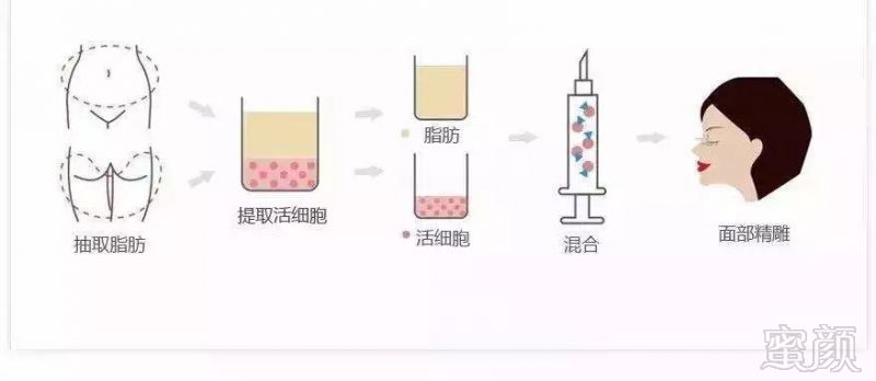https://img.miyanlife.com/mnt/timg/190909/1F95WF0-10.jpg