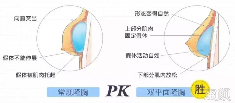 案例图片