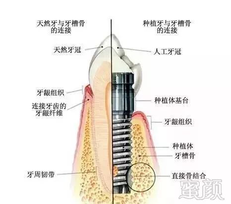 案例图片