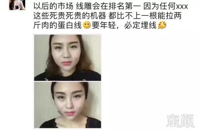 https://img.miyanlife.com/mnt/timg/190909/1GGW228-6.jpg