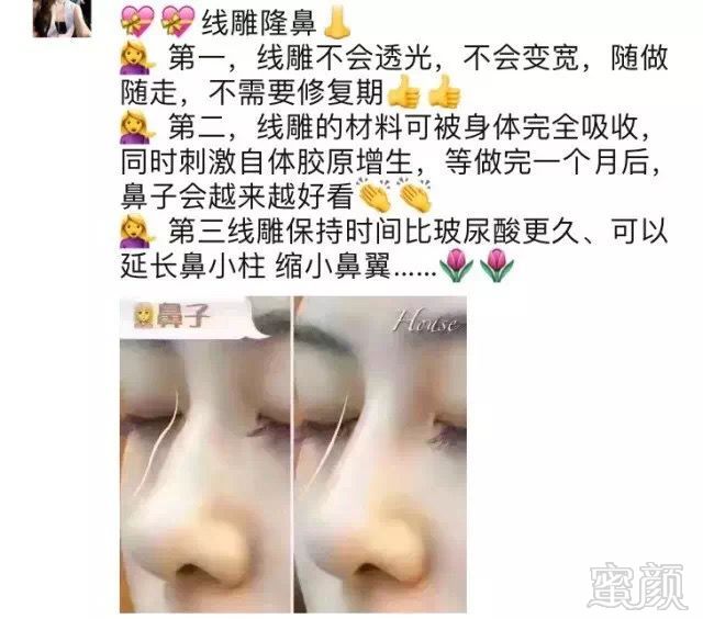 https://img.miyanlife.com/mnt/timg/190909/1GH05042-7.jpg