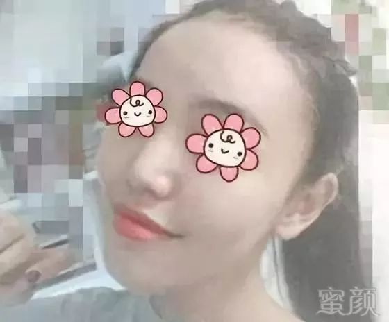 https://img.miyanlife.com/mnt/timg/190910/1553435632-2.jpg