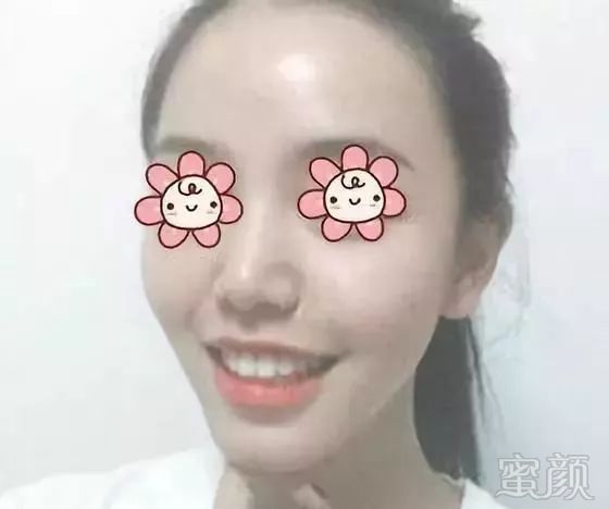 https://img.miyanlife.com/mnt/timg/190910/1553455Z1-5.jpg