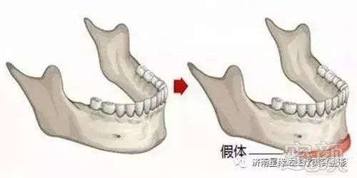 案例图片