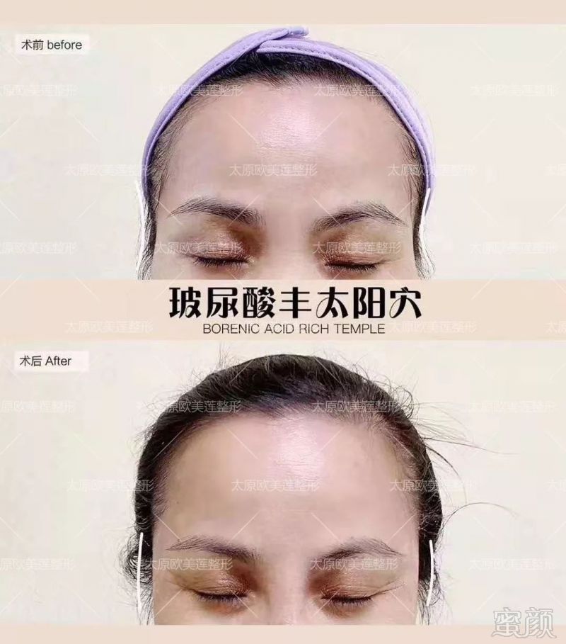 https://img.miyanlife.com/mnt/timg/190911/1626342U9-4.jpg