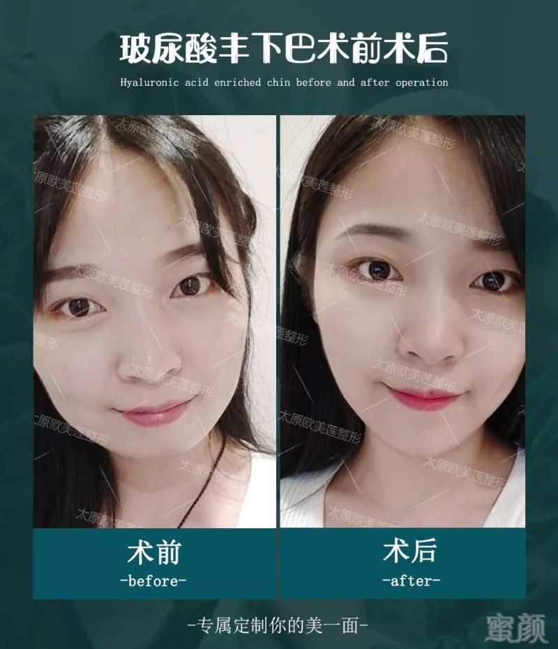 https://img.miyanlife.com/mnt/timg/190911/162635MO-5.jpg