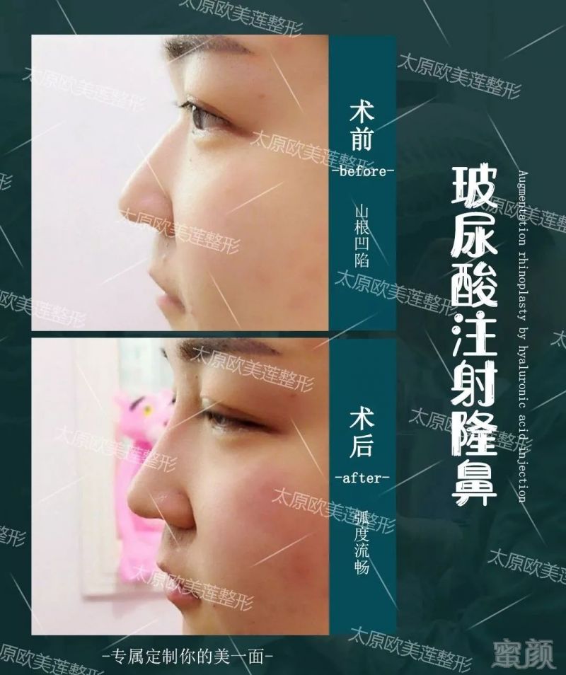 https://img.miyanlife.com/mnt/timg/190911/1626361E3-7.jpg
