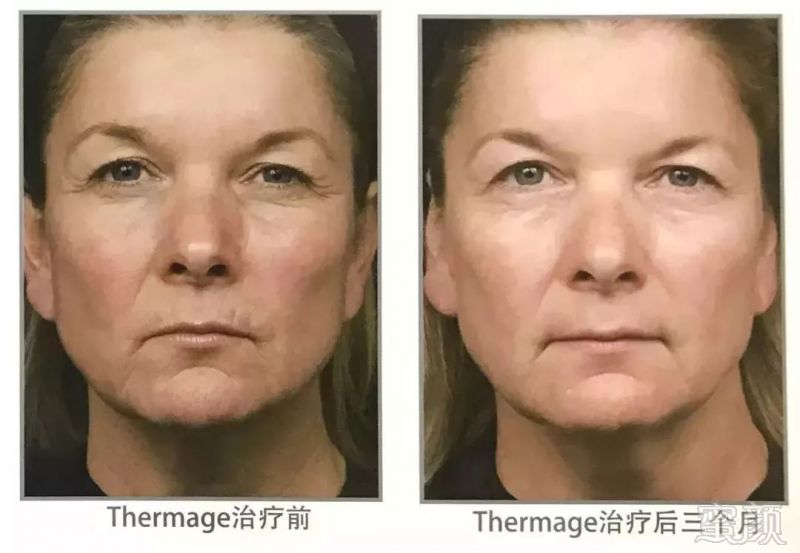 https://img.miyanlife.com/mnt/timg/190913/1054534938-5.jpg