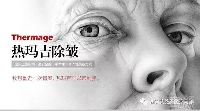 https://img.miyanlife.com/mnt/timg/190913/110310AA-0.jpg