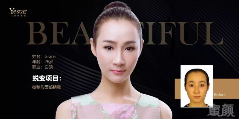 https://img.miyanlife.com/mnt/timg/190914/12233SB8-11.jpg