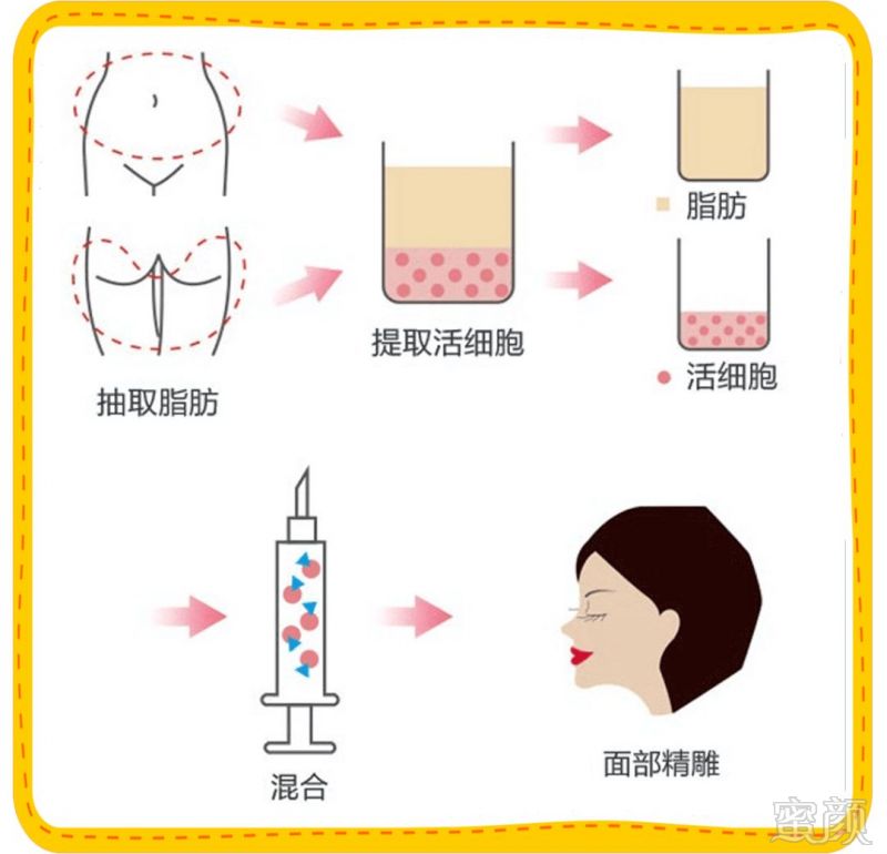 https://img.miyanlife.com/mnt/timg/190915/1121544934-1.jpg