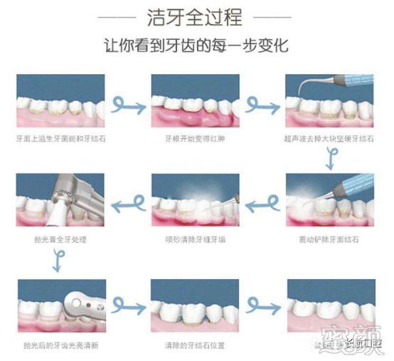 案例图片